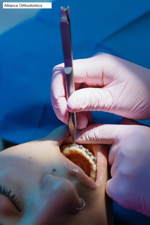 Alliance Orthodontics - carrollton
