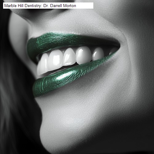 Marble Hill Dentistry: Dr. Darrell Morton