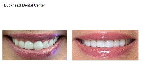 Buckhead Dental Center