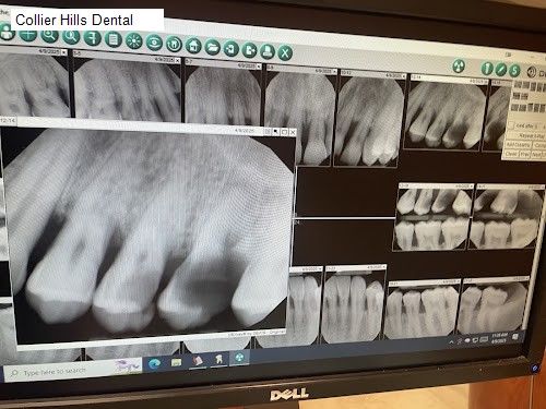 Collier Hills Dental
