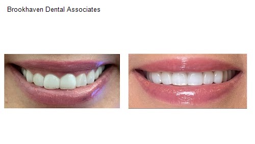 Brookhaven Dental Associates