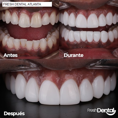 FRESH DENTAL ATLANTA
